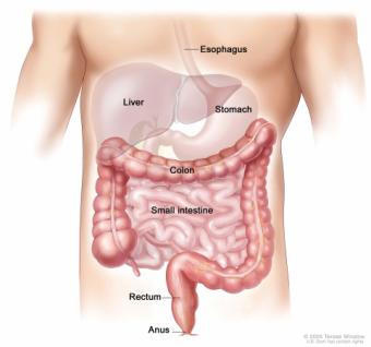 Cancerul de colon. Prevenire si tratamente